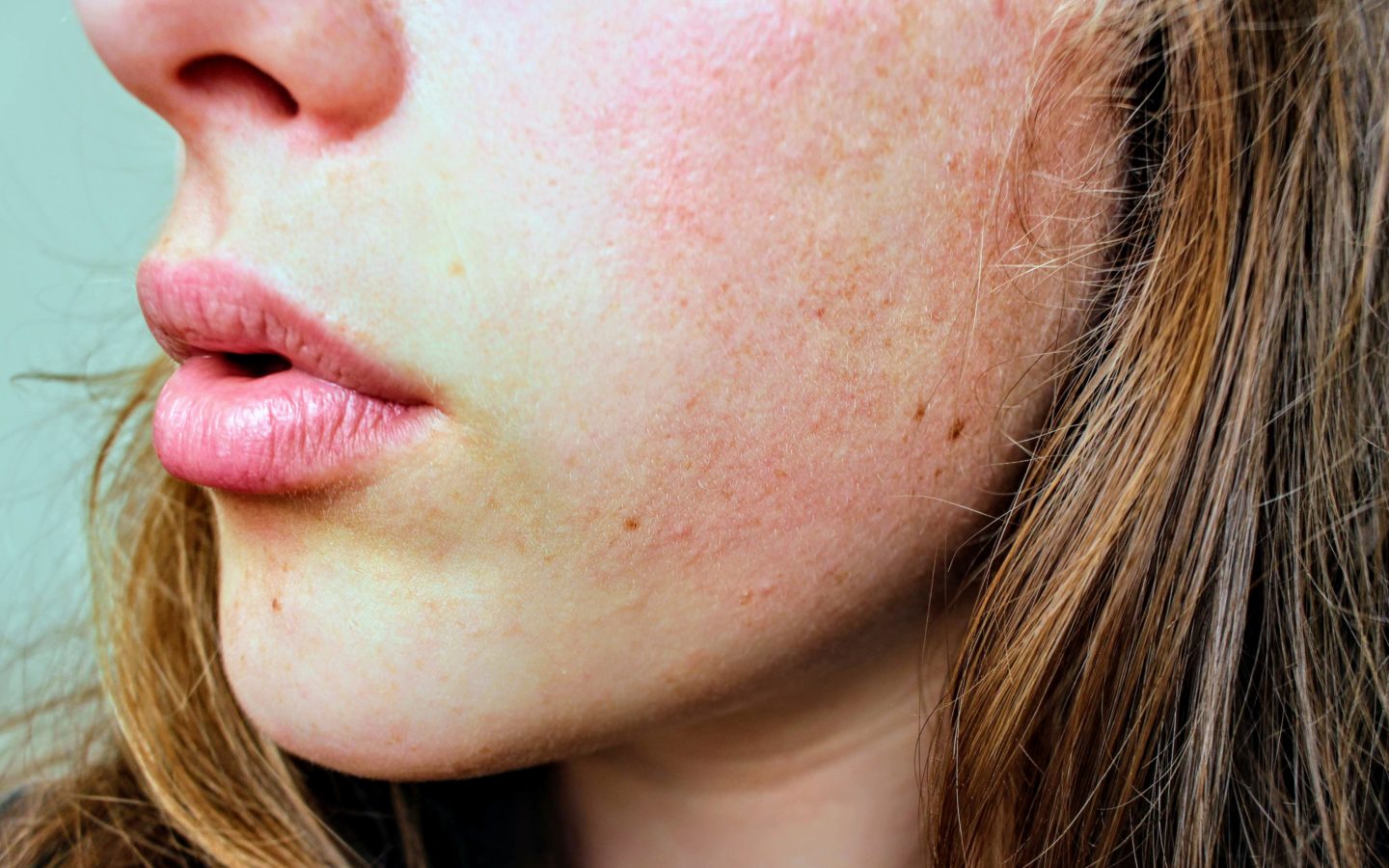 How to Fight the Anti-Aging Battle with Clinical Skincare Options